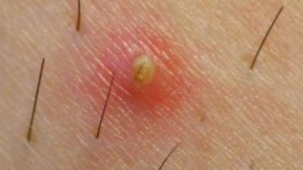 Karvan Kyntäjät: fur-tiller